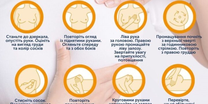 Рак молочної залози