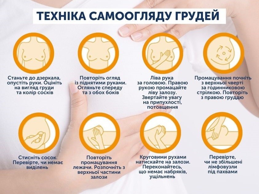 Рак молочної залози